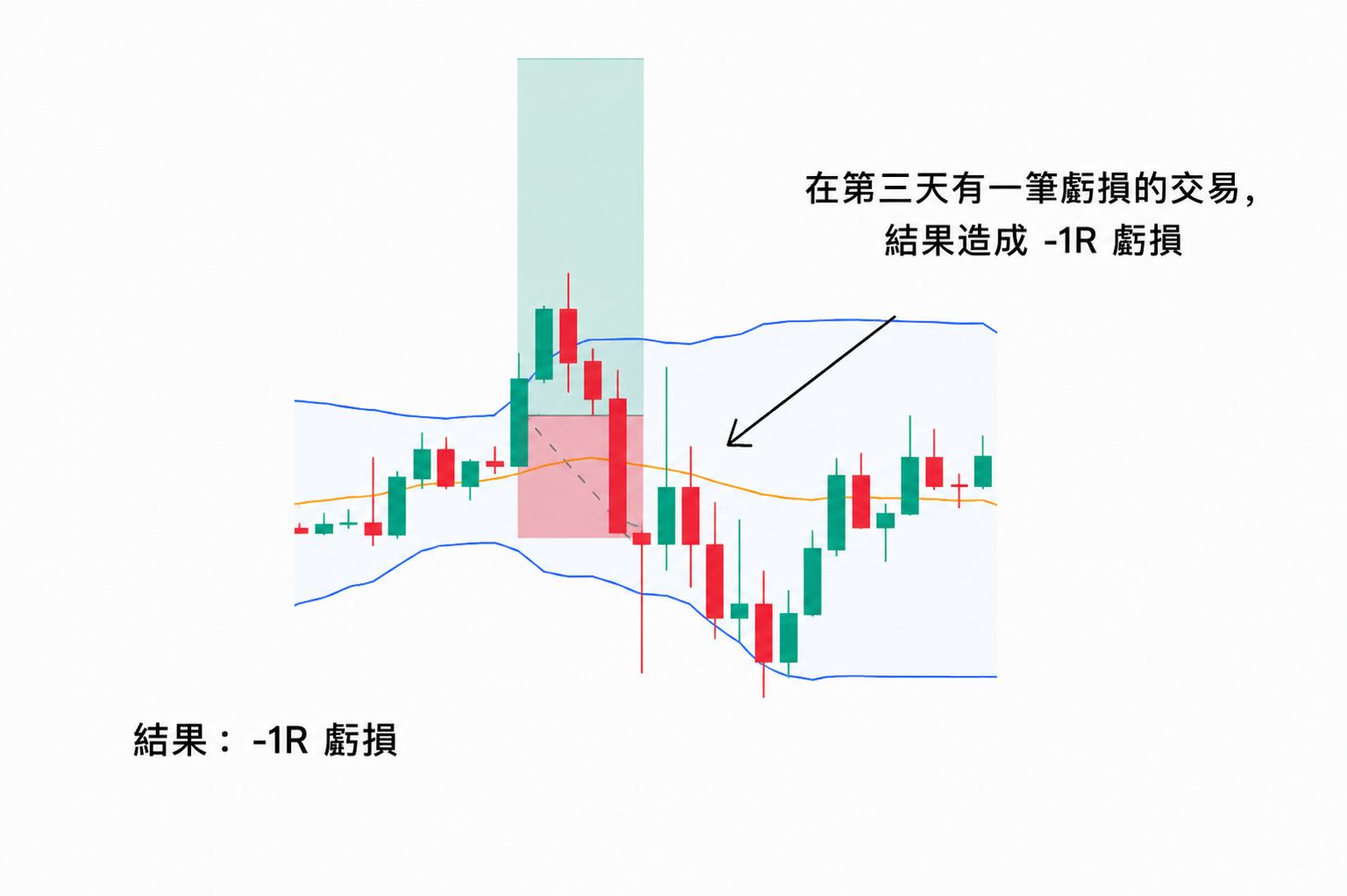 交易風險管理範例圖，展示一筆交易觸發停損並造成 1R 虧損，最終交易結果為 -1R。